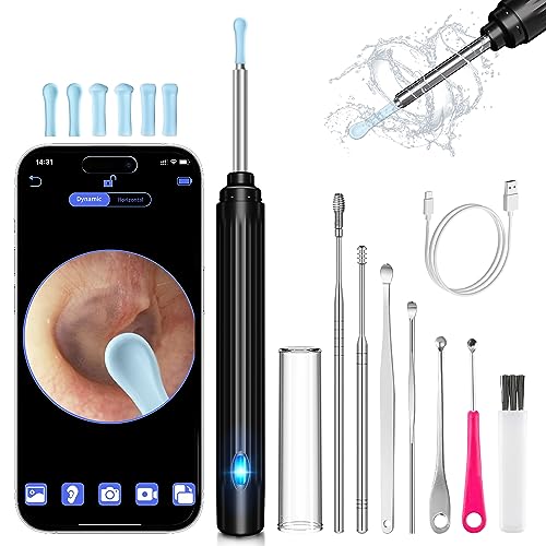 Smart Ear Wax Removal Tool with 1296P Camera - HaYiue Ear Cleaner for iPhone, Android